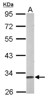 Western Blot: Musashi-2 Antibody [NBP2-19443]