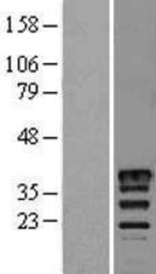 Western Blot: Musashi-2 Overexpression Lysate [NBL1-13329]