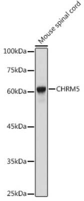 Western Blot: Muscarinic Acetylcholine Receptor M5/CHRM5 AntibodyAzide and BSA Free [NBP2-94150]