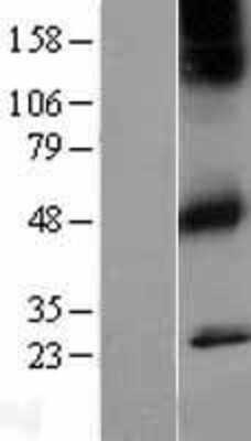 Western Blot: Muscarinic Acetylcholine Receptor M1/CHRM1 Overexpression Lysate [NBL1-09173]