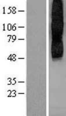 Western Blot: Muscarinic Acetylcholine Receptor M2/CHRM2 Overexpression Lysate [NBL1-09174]