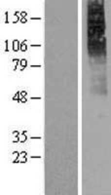 Western Blot: Muscarinic Acetylcholine Receptor M2/CHRM2 Overexpression Lysate [NBP2-08825]