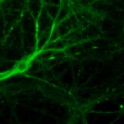 Immunocytochemistry/ Immunofluorescence: Muscarinic Acetylcholine Receptor M1/CHRM1 Antibody [NBP1-87466]