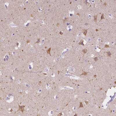 Immunohistochemistry-Paraffin: Muscarinic Acetylcholine Receptor M1/CHRM1 Antibody [NBP1-87466]