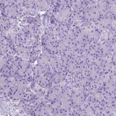 Immunohistochemistry-Paraffin: Muscarinic Acetylcholine Receptor M1/CHRM1 Antibody [NBP1-87466]