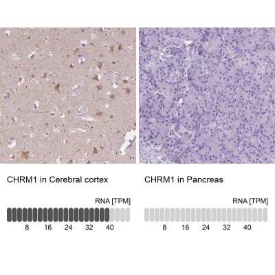 Immunohistochemistry-Paraffin: Muscarinic Acetylcholine Receptor M1/CHRM1 Antibody [NBP1-87466]