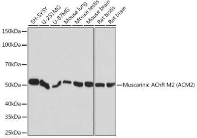 Western Blot: Muscarinic Acetylcholine Receptor M2/CHRM2 Antibody (3T5W8) [NBP3-16576]