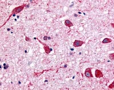 Immunohistochemistry-Paraffin: Muscarinic Acetylcholine Receptor M2/CHRM2 Antibody - BSA Free [NLS1331]
