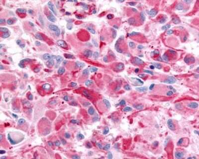 Immunohistochemistry-Paraffin: Muscarinic Acetylcholine Receptor M2/CHRM2 Antibody - BSA Free [NLS1331]