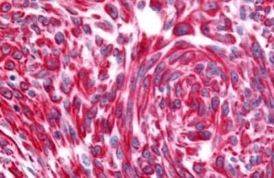 Immunohistochemistry-Paraffin: Muscarinic Acetylcholine Receptor M2/CHRM2 Antibody - BSA Free [NLS1331]