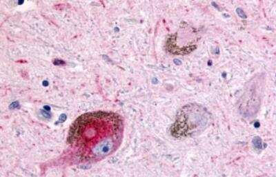 Immunohistochemistry-Paraffin: Muscarinic Acetylcholine Receptor M2/CHRM2 Antibody - BSA Free [NLS1331]