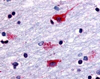 Immunohistochemistry-Paraffin: Muscarinic Acetylcholine Receptor M2/CHRM2 Antibody - BSA Free [NLS1333]