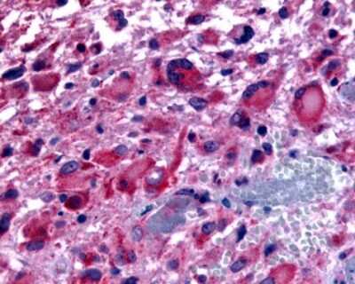 Immunohistochemistry-Paraffin: Muscarinic Acetylcholine Receptor M2/CHRM2 Antibody - BSA Free [NLS1333]