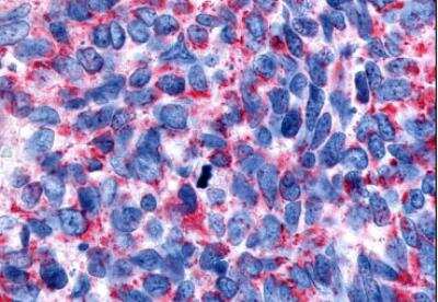 Immunohistochemistry-Paraffin: Muscarinic Acetylcholine Receptor M2/CHRM2 Antibody - BSA Free [NLS1333]