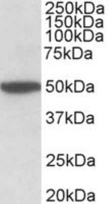 Western Blot: Muscarinic Acetylcholine Receptor M2/CHRM2 Antibody [NBP2-26152]