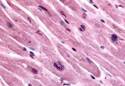 Immunohistochemistry-Paraffin: Muscarinic Acetylcholine Receptor M3/CHRM3 Antibody - BSA Free [NB100-58975]