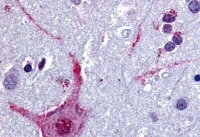 Immunohistochemistry-Paraffin: Muscarinic Acetylcholine Receptor M3/CHRM3 Antibody - BSA Free [NB100-58978]