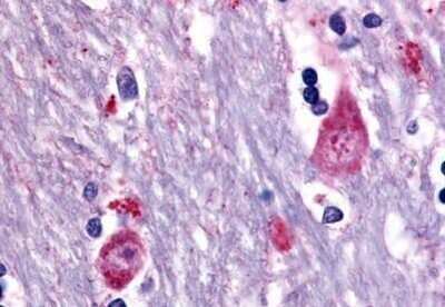 Immunohistochemistry-Paraffin: Muscarinic Acetylcholine Receptor M3/CHRM3 Antibody - BSA Free [NB100-59004]