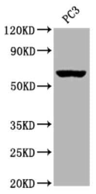 Western Blot: Muscarinic Acetylcholine Receptor M3/CHRM3 Antibody (2D4) [NBP3-15165]