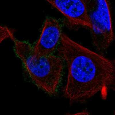 Immunocytochemistry/ Immunofluorescence: Muscarinic Acetylcholine Receptor M3/CHRM3 Antibody [NBP2-56624]