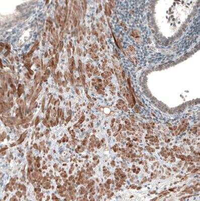 Immunohistochemistry-Paraffin: Muscarinic Acetylcholine Receptor M3/CHRM3 Antibody [NBP1-87547]