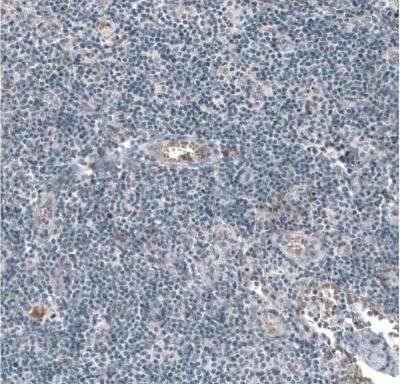 Immunohistochemistry-Paraffin: Muscarinic Acetylcholine Receptor M3/CHRM3 Antibody [NBP1-87547]