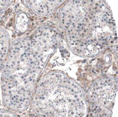Immunohistochemistry-Paraffin: Muscarinic Acetylcholine Receptor M3/CHRM3 Antibody [NBP1-87547]