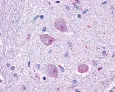 Immunohistochemistry-Paraffin: Muscarinic Acetylcholine Receptor M4/CHRM4 Antibody - BSA Free [NLS220]