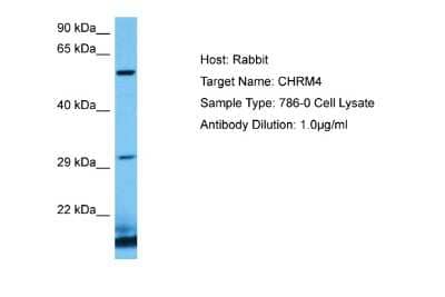 Western Blot: Muscarinic Acetylcholine Receptor M4/CHRM4 Antibody [NBP2-86718]