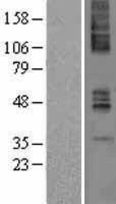 Western Blot: Muscarinic Acetylcholine Receptor M4/CHRM4 Overexpression Lysate [NBP2-04174]