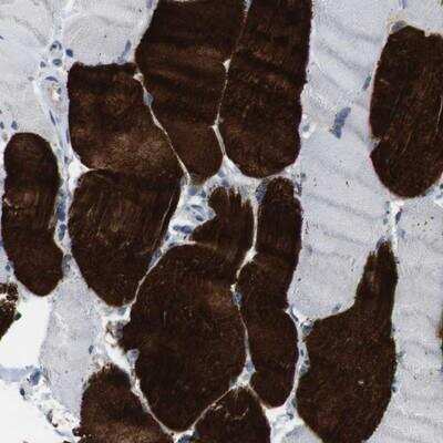 Immunohistochemistry-Paraffin: Muscarinic Acetylcholine Receptor M5/CHRM5 Antibody [NBP1-87578]