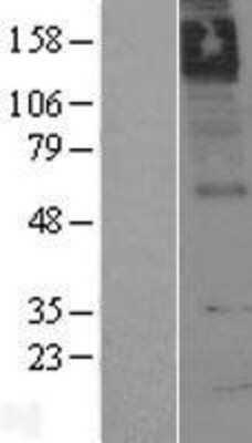 Western Blot: Muscarinic Acetylcholine Receptor M5/CHRM5 Overexpression Lysate [NBL1-09177]