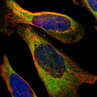 Immunocytochemistry/ Immunofluorescence: Muscle Phosphofructokinase/PFKM/PFK-1 Antibody [NBP1-87293]
