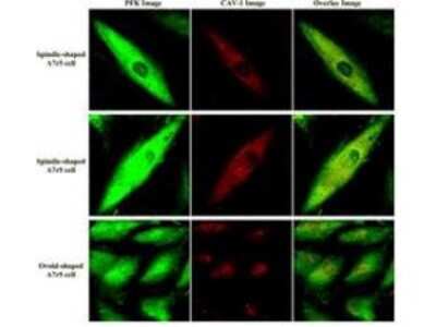 Immunocytochemistry/ Immunofluorescence: Muscle Phosphofructokinase/PFKM/PFK-1 Antibody [NBP2-44228]