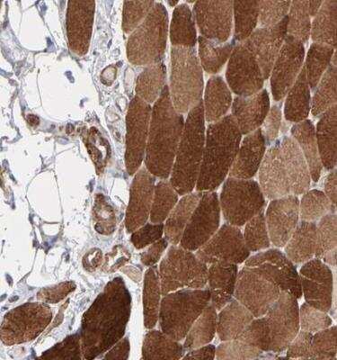 Immunohistochemistry-Paraffin: Muscle Phosphofructokinase/PFKM/PFK-1 Antibody [NBP1-87293]