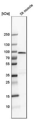 Western Blot: Muscle Phosphofructokinase/PFKM/PFK-1 Antibody [NBP1-87293]