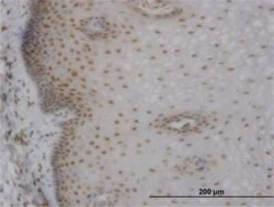 Immunohistochemistry-Paraffin: Muscleblind-like 1 Antibody (3E7) [H00004154-M02]