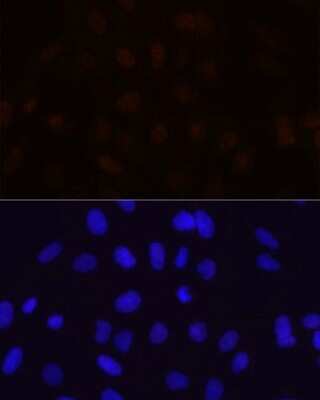 Immunocytochemistry/ Immunofluorescence: Muscleblind-like 1 Antibody (7N6W3) [NBP3-16574]