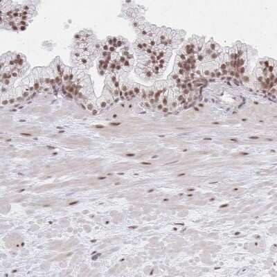 Immunohistochemistry-Paraffin: Muscleblind-like 1 Antibody [NBP2-55165]