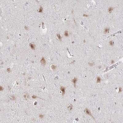Immunohistochemistry-Paraffin: Muscleblind-like 1 Antibody [NBP2-55165]