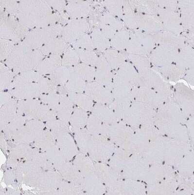 Immunohistochemistry-Paraffin: Muscleblind-like 1 Antibody [NBP2-55165]