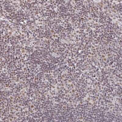 Immunohistochemistry-Paraffin: Muscleblind-like 1 Antibody [NBP2-55165]