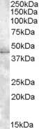 Western Blot: Muscleblind-like 1 Antibody [NBP1-06990]