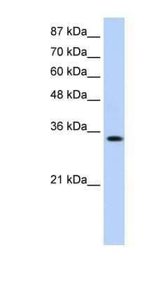 Western Blot: Muscleblind-like 1 Antibody [NBP1-80488]