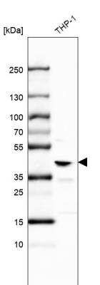 Western Blot: Muscleblind-like 1 Antibody [NBP2-55165]