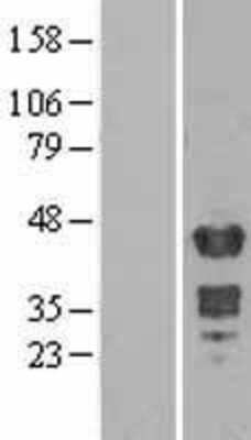 Western Blot: Muscleblind-like 1 Overexpression Lysate [NBP2-04382]