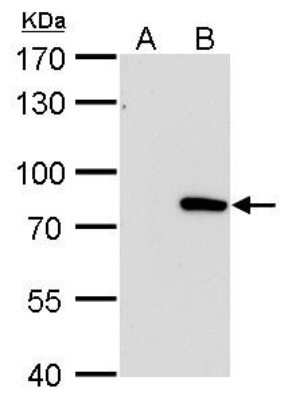 Western Blot: MxA/Mx1 Antibody (4812) [NBP2-43704]