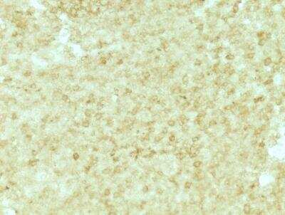 Immunohistochemistry-Paraffin: MxA/Mx1 Antibody [NBP1-32905]