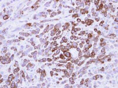 Immunohistochemistry-Paraffin: MxA/Mx1 Antibody [NBP1-33033]