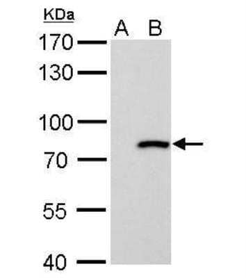 Western Blot: MxA/Mx1 Antibody [NBP1-32905]